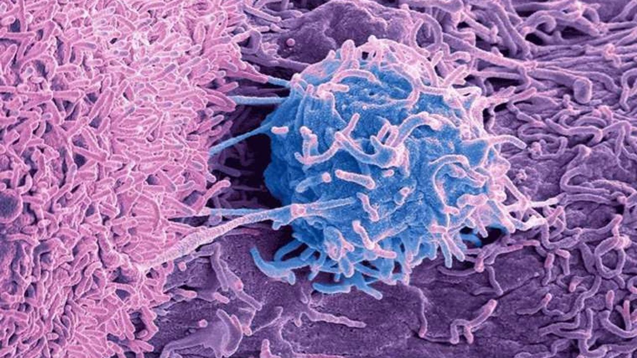 Tümörlerde yaşayan mikroplar, kanserin nedeni ve tedavisiyle ilgili ne tür ipuçları veriyor?