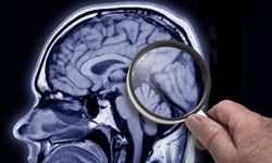 Demans ve Alzheimer: Belirtileri nedir, hangi tedaviler uygulanıyor?