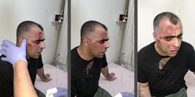 Tatvan'da Gazeteci Sinan Aygül’e çirkin saldırı