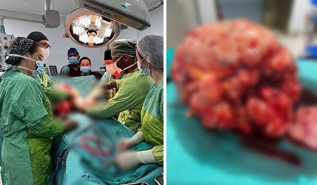 Hastanın karnından çıktı, tam 26 kilo! Doktorları bile şaşırtan olay